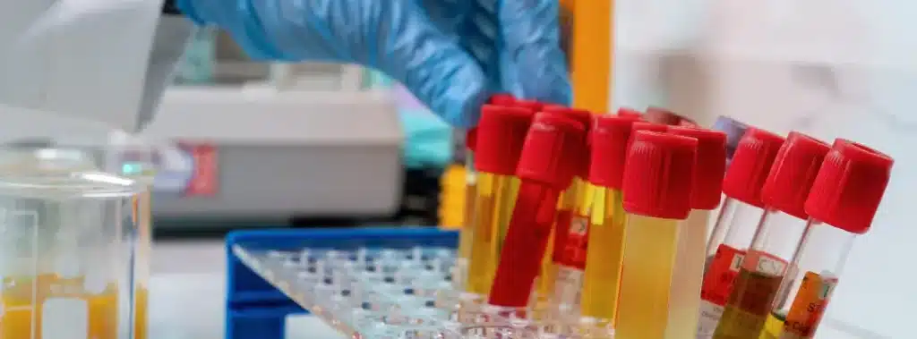 Drug Testing for Crack