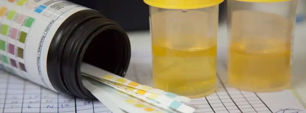 Urine Test for Fentanyl