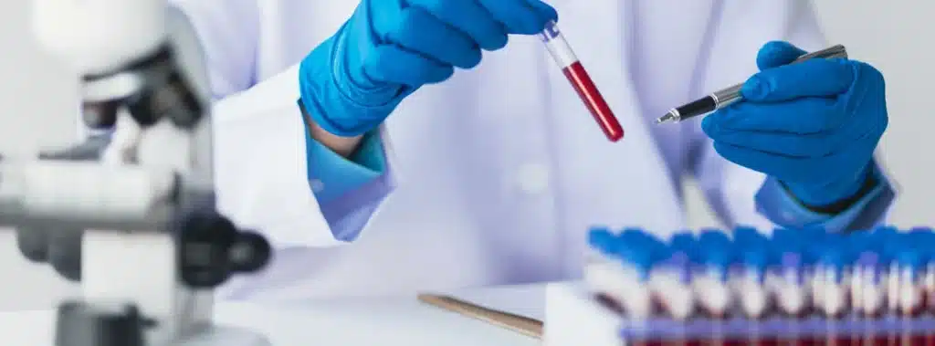 Oxycontin Present in the Blood