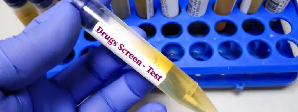 Drug Screenings