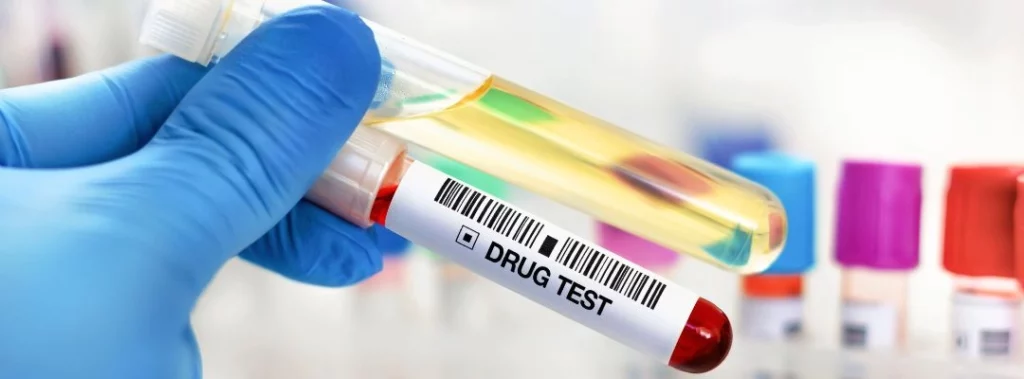 What EtG level does probation use