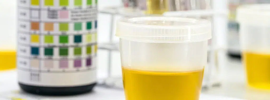 Urine Drug Test for Percocet