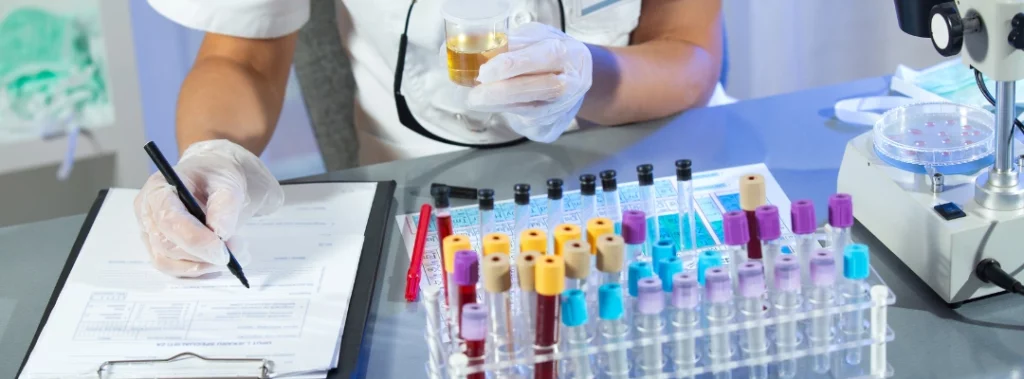 Image of a lab technician holding a specimen for a drug test - Do You Get Drug Tested at a Substance Abuse Evaluation - Purpose Healing Center