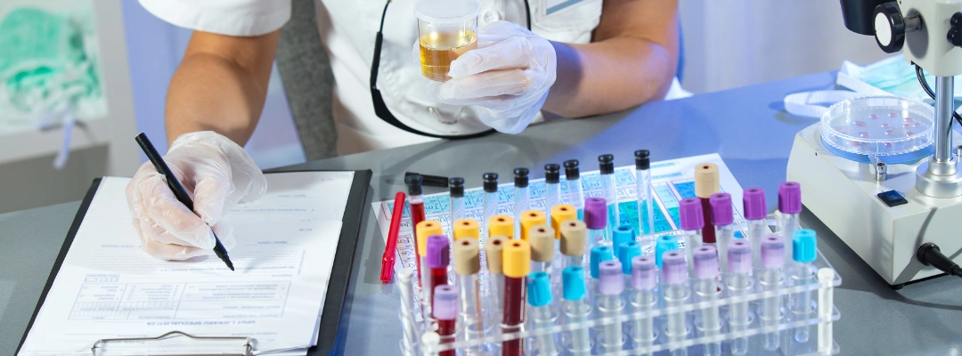 Image of a lab technician holding a specimen for a drug test - Do You Get Drug Tested at a Substance Abuse Evaluation - Purpose Healing Center