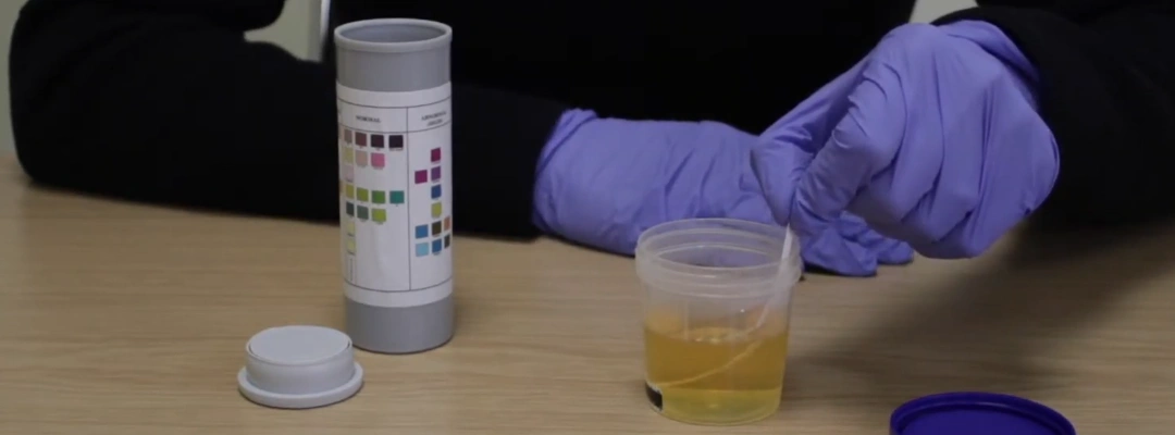 Close-up of synthetic urine kit used to cheat drug tests, highlighting risks of legal and employment consequences